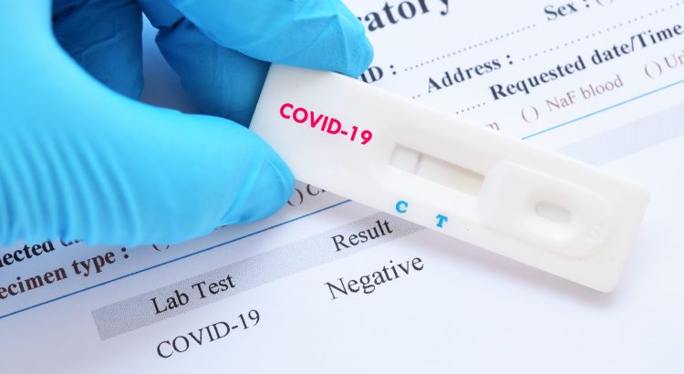Тестирање на COVID-19 (PCR) на лични захтев